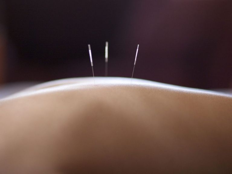 Can acupuncture improve your sex life?